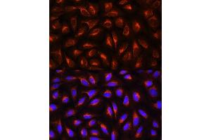 anti-C-Reactive Protein (CRP) (AA 1-224) antibody
