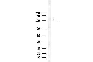 anti-G Protein-Coupled Receptor 144 (GPR144) antibody