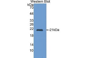 Western Blotting (WB) image for anti-Cathepsin L1 (CTSL1) (AA 114-288) antibody (ABIN1172740) (Cathepsin L anticorps  (AA 114-288))