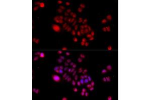 Immunofluorescence analysis of HeLa cells using DNAJB6 antibody.