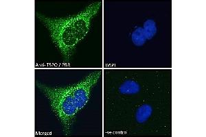 ABIN185697 Immunofluorescence analysis of paraformaldehyde fixed HeLa cells, permeabilized with 0.