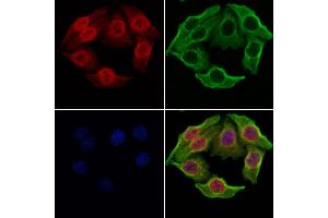 ABIN6264918 and ABIN6277937 staining Hela cells by IF/ICC. (SALL4 anticorps  (Internal Region))