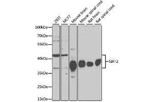 Western blot analysis of extracts of various cell lines, using SIRT2 antibody. (SIRT2 anticorps)