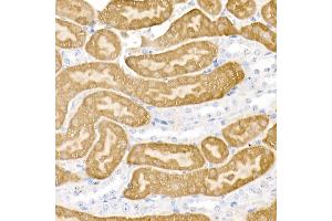 Immunohistochemistry of paraffin-embedded mouse kidney using DDC Rabbit pAb (ABIN1679510, ABIN3018150, ABIN3018151 and ABIN6220384) at dilution of 1:25 (40x lens).