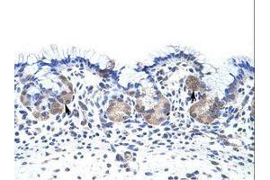 Image no. 1 for anti-UPF3 Regulator of Nonsense Transcripts Homolog B (UPF3B) (N-Term) antibody (ABIN203166)