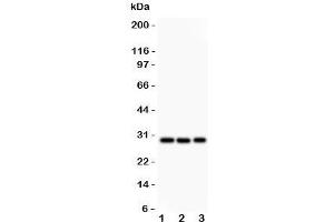 Western blot testing of CSEN antibody and Lane 1:  HeLa;  2: U87;  3: SHG-44 lysate.
