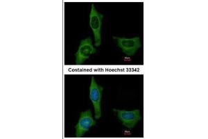 ICC/IF Image Immunofluorescence analysis of methanol-fixed HeLa, using Factor X, antibody at 1:200 dilution. (Coagulation Factor X anticorps)