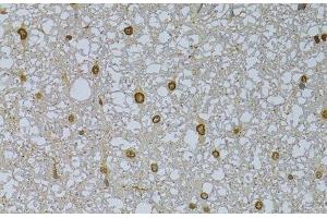Immunohistochemistry of paraffin-embedded Rat spinal cord using HDGFRP3 Polyclonal Antibody at dilution of 1:100 (40x lens). (HDGFRP3 anticorps)