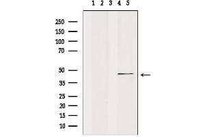 Western blot analysis of extracts from mouse brain, using CKI-ε Antibody.