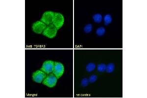 ABIN263177 Immunofluorescence analysis of paraformaldehyde fixed A431 cells, permeabilized with 0.