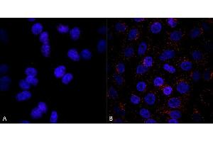 Immunocytochemistry/Immunofluorescence analysis using Mouse Anti-VPS35 Monoclonal Antibody, Clone 8A3 (ABIN6932960).