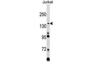 Western blot analysis in Jurkat cell line lysates (35ug/lane) using CD171 / L1CAM Antibody . (L1CAM anticorps  (C-Term))