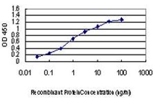 Detection limit for recombinant GST tagged IRAK2 is approximately 0. (IRAK2 anticorps  (AA 111-210))