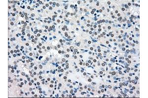 Immunohistochemical staining of paraffin-embedded pancreas tissue using anti-BRAFmouse monoclonal antibody. (BRAF anticorps)