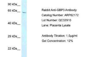 Western Blotting (WB) image for anti-Guanylate Binding Protein 3 (GBP3) (N-Term) antibody (ABIN2789048)