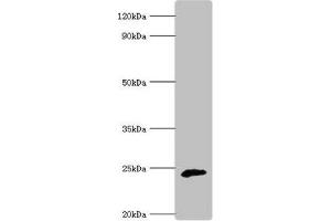 Western blot All lanes: Ubiquinone biosynthesis protein COQ7 homolog antibody at 6 μg/mL + Rat heart tissue Secondary Goat polyclonal to rabbit IgG at 1/10000 dilution Predicted band size: 25, 21 kDa Observed band size: 25 kDa (Coq7 anticorps  (AA 37-217))