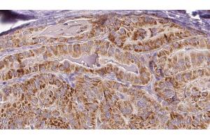 anti-Afadin (MLLT4) (pSer1799) antibody