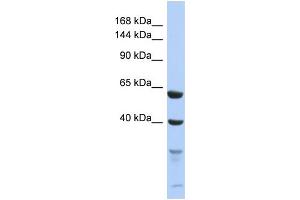 Western Blotting (WB) image for anti-Testis Expressed 11 (TEX11) (C-Term) antibody (ABIN2786547)