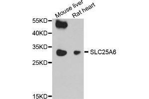 Western blot analysis of extract of mouse liver and rat heart cells, using SLC25A6 antibody. (SLC25A6 anticorps)