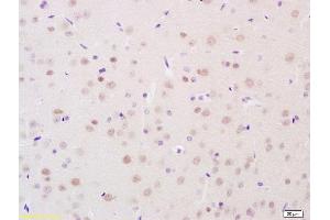 Formalin-fixed and paraffin embedded horse kidney labeled with Anti- HSD11B2 Polyclonal Antibody, Unconjugated  at 1:200 followed by conjugation to the secondary antibody and DAB staining