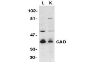 Western blot analysis of CAD in mouse lung (L) and kidney (K) tissue lysates with AP30175PU-N CAD antibody at 1/500 dilution.