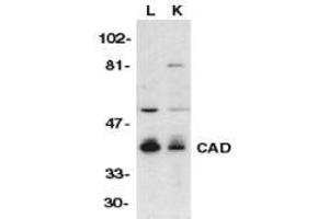 Western blot analysis of CAD in mouse lung (L) and kidney (K) tissue lysates with AP30175PU-N CAD antibody at 1/500 dilution.