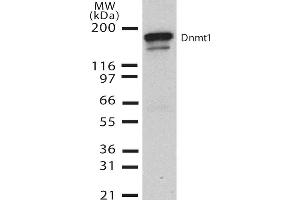 Western Blot analysis of Human H1299 cell lysate showing detection of DNMT1 protein using Mouse Anti-DNMT1 Monoclonal Antibody, Clone 60B1220. (DNMT1 anticorps  (AA 637-650) (PE))