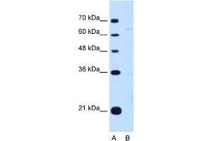 WB Suggested Anti-DONSON Antibody Titration:  0.