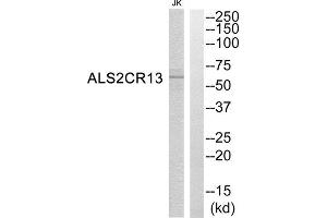 Western Blotting (WB) image for anti-Family with Sequence Similarity 117, Member B (FAM117B) (C-Term) antibody (ABIN1850761) (FAM117B anticorps  (C-Term))