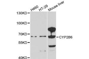 Western blot analysis of extracts of various cell lines, using CYP2B6 antibody. (CYP2B6 anticorps)