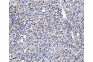 IHC analysis of Hsp47/SERPINH1 using anti-Hsp47/SERPINH1 antibody (ABIN3043331). (SERPINH1 anticorps  (AA 247-418))