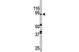 Western blot analysis of LSD1 antibody and mouse brain tissue lysate.