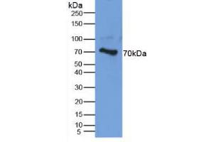 Western blot analysis of Human Cartilage Tissue. (Aggrecan anticorps  (AA 34-147))