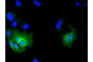 Image no. 9 for anti-Acetyl-CoA Acetyltransferase 2 (ACAT2) antibody (ABIN1496402) (ACAT2 anticorps)