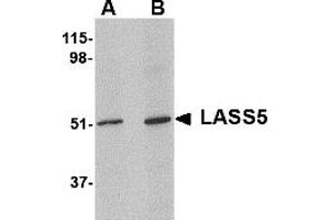 Western Blotting (WB) image for anti-LAG1 Homolog, Ceramide Synthase 5 (LASS5) (N-Term) antibody (ABIN1031694) (LASS5 anticorps  (N-Term))