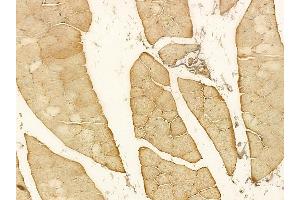ST7 Mouse Monoclonal Antibody at 1/100 staining rat muscle tissue by IHC-P. (ST7 anticorps)