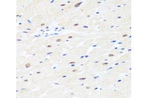 Immunohistochemistry of paraffin-embedded Rat heart using BRMS1 Polyclonal Antibody at dilution of 1:100 (40x lens). (BRMS1 anticorps)