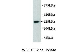 Image no. 1 for anti-tyrosine Kinase with Immunoglobulin-Like and EGF-Like Domains 1 (TIE1) antibody (ABIN1112934) (TIE1 anticorps)