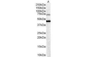 Western Blotting (WB) image for anti-Forkhead Box G1 (FOXG1) (C-Term) antibody (ABIN2465212) (FOXG1 anticorps  (C-Term))