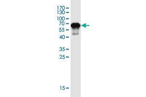 Western Blot detection against Immunogen (46. (ZNF428 anticorps  (AA 1-188))