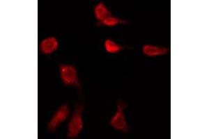 ABIN6276014 staining HeLa by IF/ICC. (GPR149 anticorps  (Internal Region))