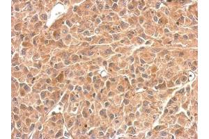 IHC-P Image GPBB antibody detects PYGB protein at cytosol on U87 xenograft by immunohistochemical analysis.