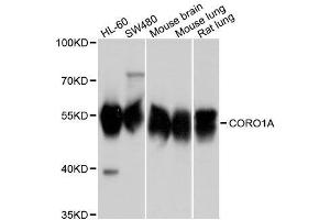 Western blot analysis of extracts of various cell lines, using CORO1A antibody. (Coronin 1a anticorps  (AA 362-461))