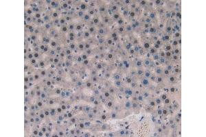 IHC-P analysis of liver tissue, with DAB staining. (Superoxide dismutase copper chaperone anticorps  (AA 27-268))
