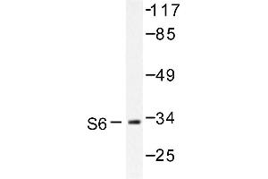 Image no. 1 for anti-Ribosomal Protein S6 (RPS6) antibody (ABIN272077) (RPS6 anticorps)