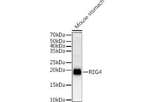 Western blot analysis of extracts of Mouse stomach, using REG4 antibody (ABIN6132619, ABIN6146859, ABIN6146860 and ABIN6217007) at 1:1000 dilution. (REG4 anticorps  (AA 23-158))
