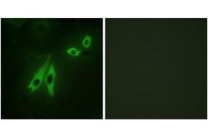 Immunofluorescence analysis of NIH-3T3 cells, using AKAP3 Antibody. (AKAP3 anticorps  (AA 191-240))