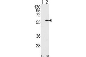 Western Blotting (WB) image for anti-Macrophage Stimulating 1 (Hepatocyte Growth Factor-Like) (MST1) antibody (ABIN3003576)