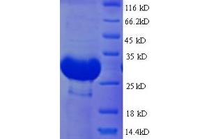 BtuF (AA 24-266) protein (His tag)
