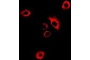 Immunofluorescent analysis of GlyRS staining in MCF7 cells. (GlyRS anticorps)